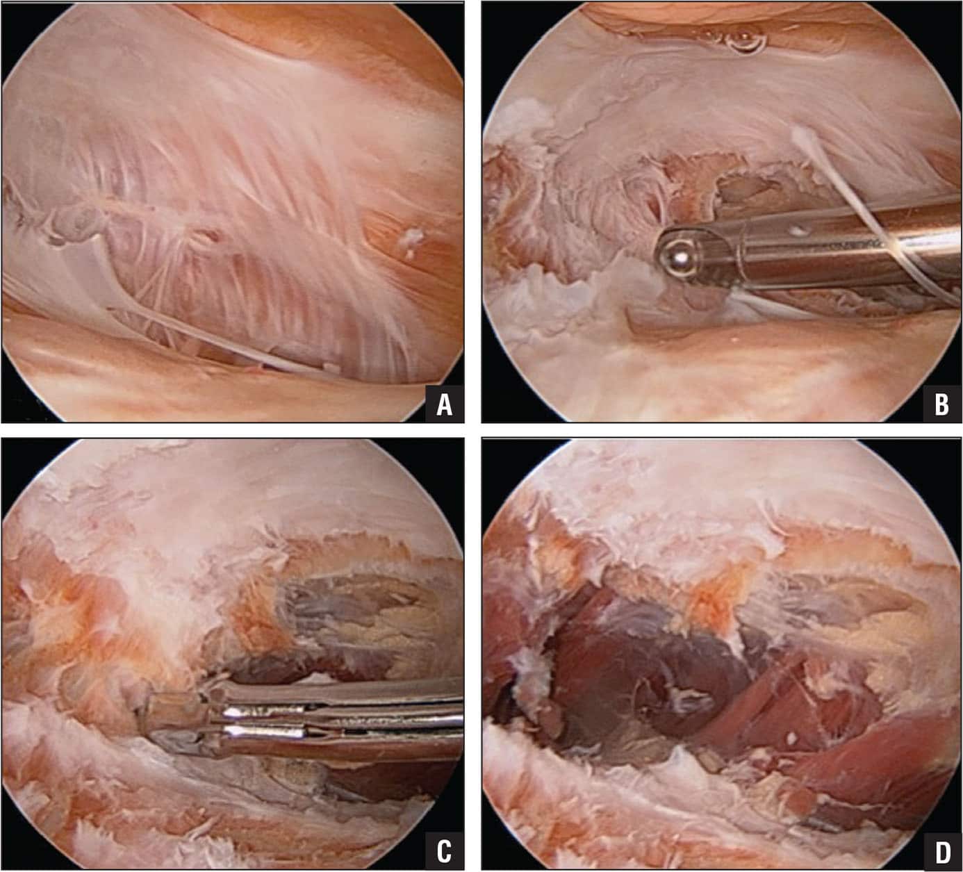 Nonligamentous Soft Tissue Pathology About the Knee: A Review