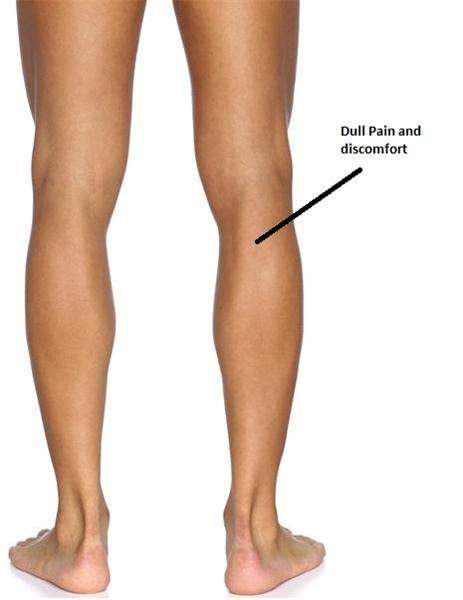 Pain/Discomfort Back Of Leg (Behind The Knee) â Runner