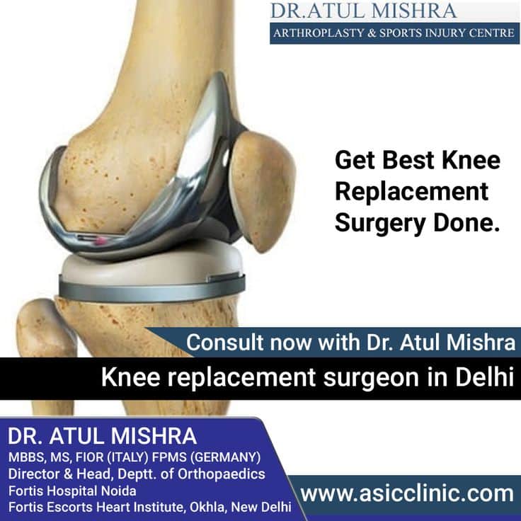 Pin on Best Knee Replacement Surgeon in Delhi