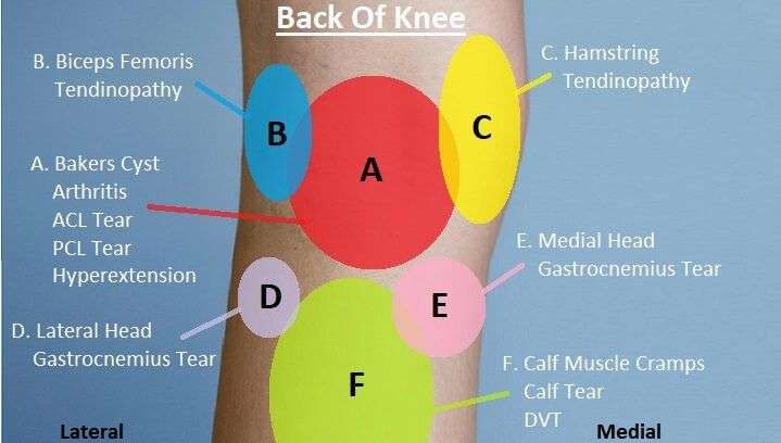 Pin on Knee pain diagnosis