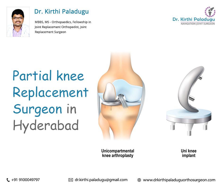 Pin on knee replacement surgery in Hyderabad
