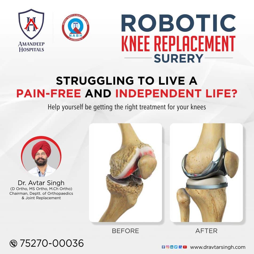 Pin on Robotic Knee Replacement
