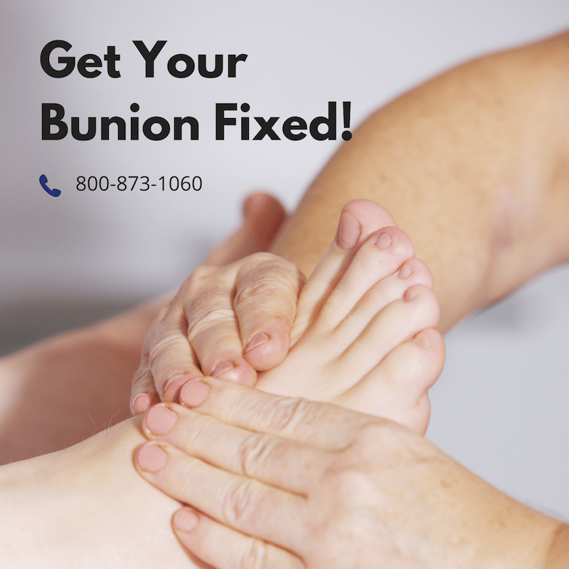 Pin on The Bunion Cure