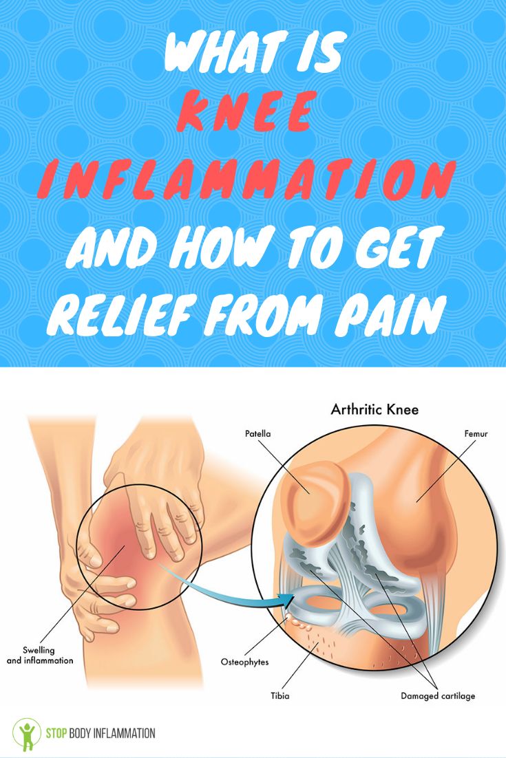 Pin su Best of Stop Body Inflammation