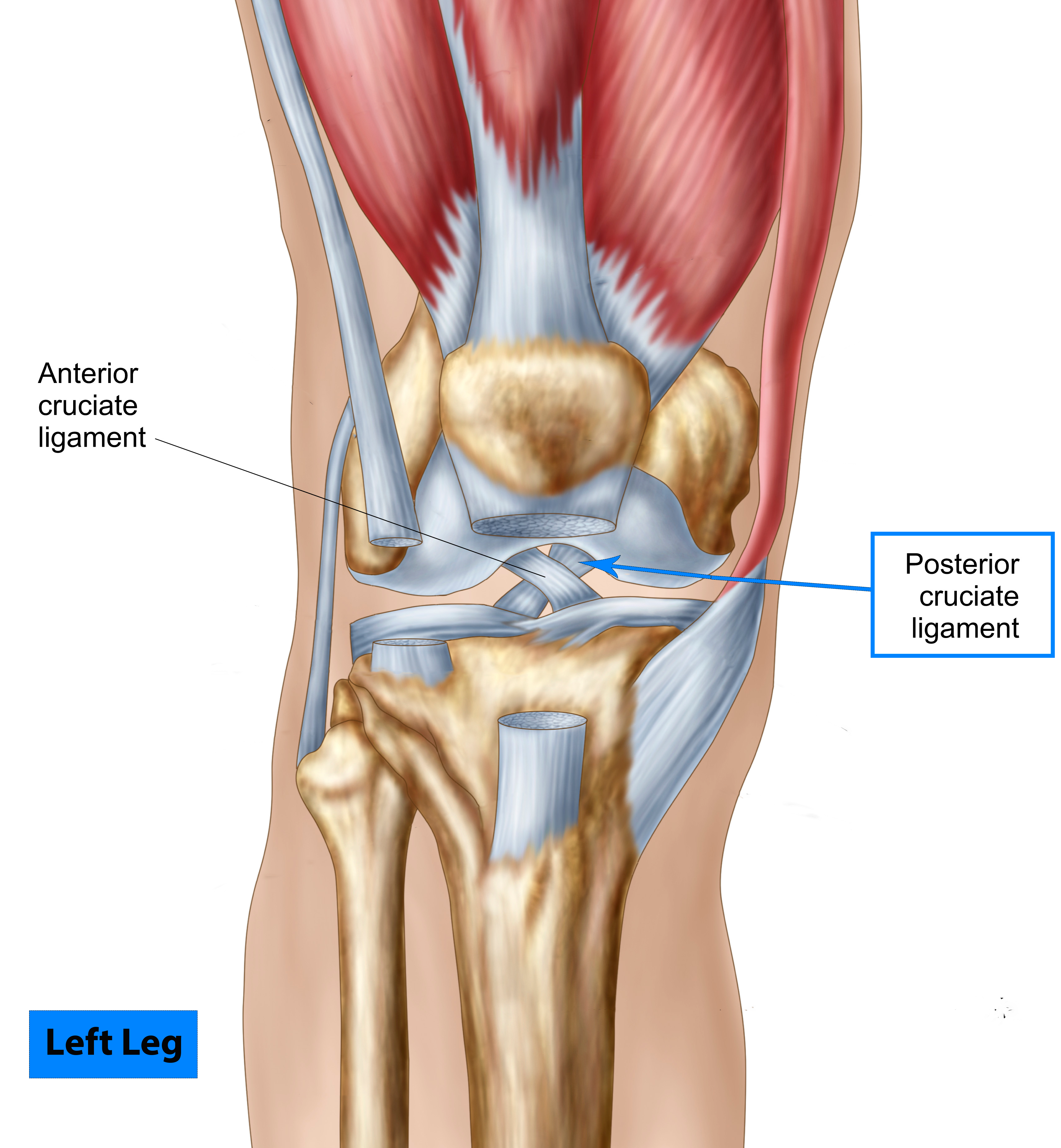 Posterior Cruciate Ligament Injury