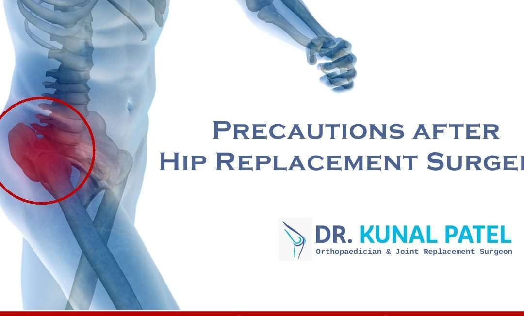 Precautions after Hip Replacement Surgery by Dr. Kunal