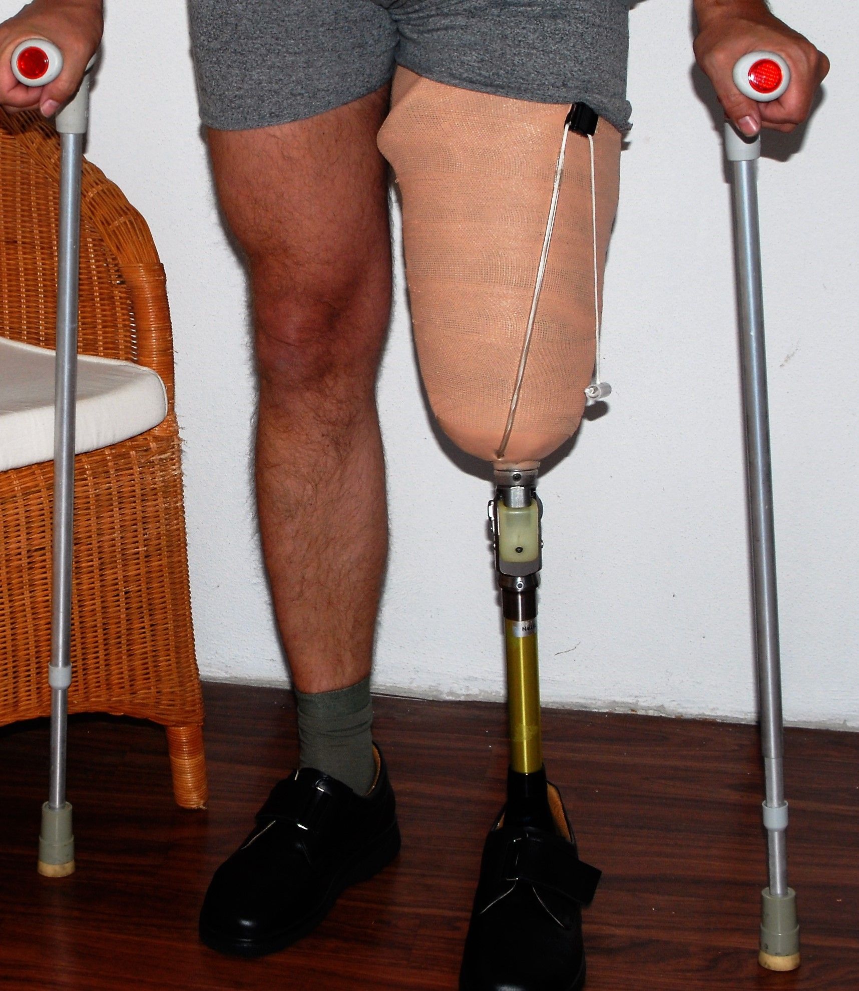 Pretender prosthetic leg for simulating a left above knee amputation ...
