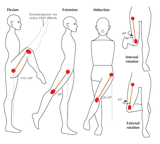 Range of Motion After Joint Replacement Surgery