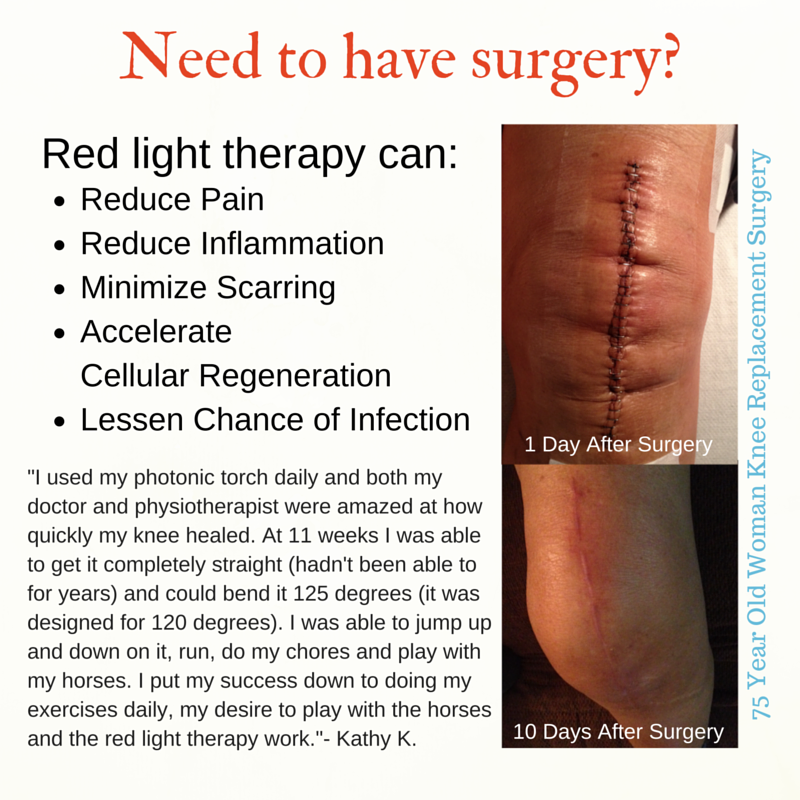 Red Light therapy applied to 10