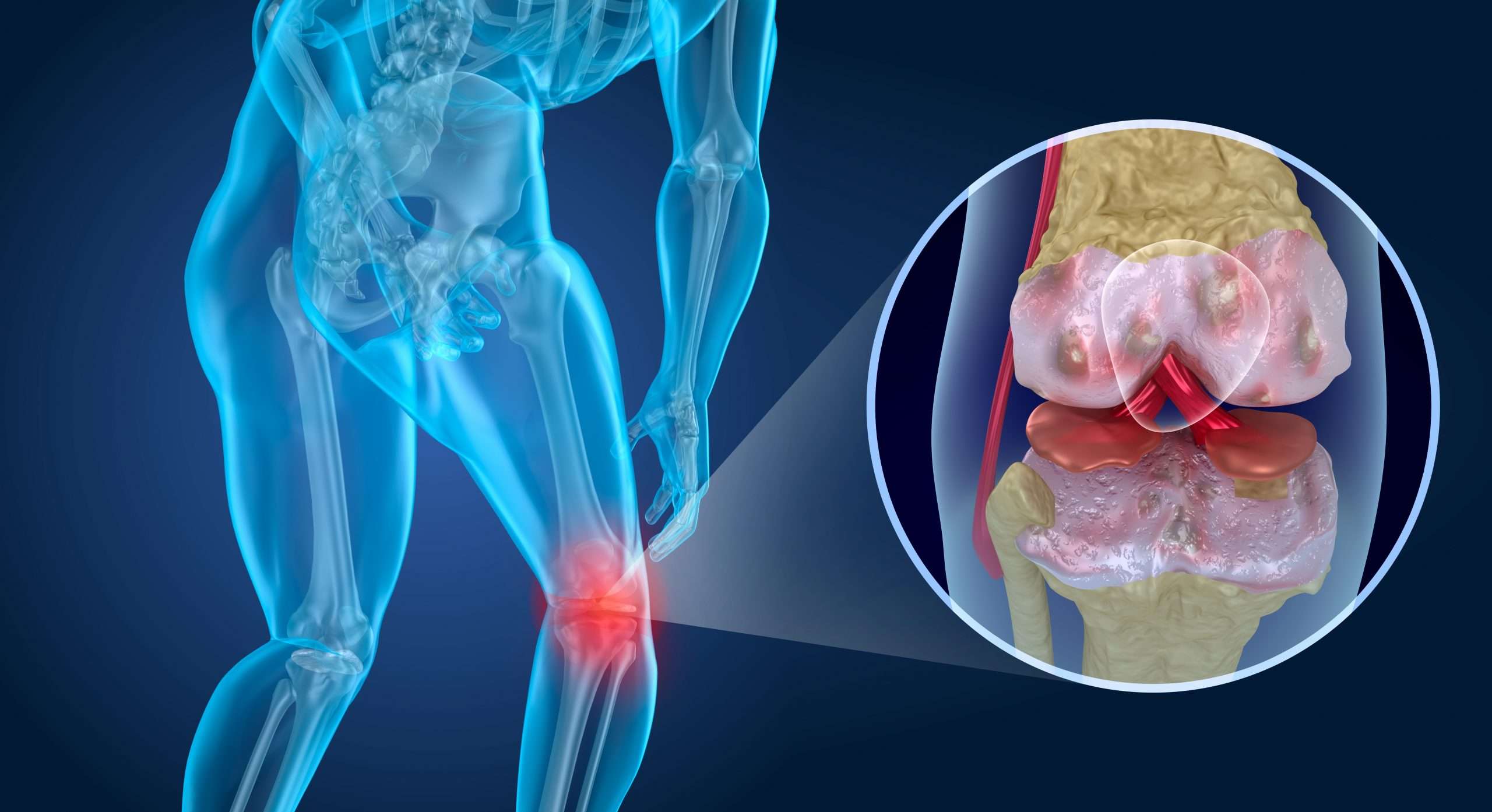 Regrow Knee Cartilage? Promising research