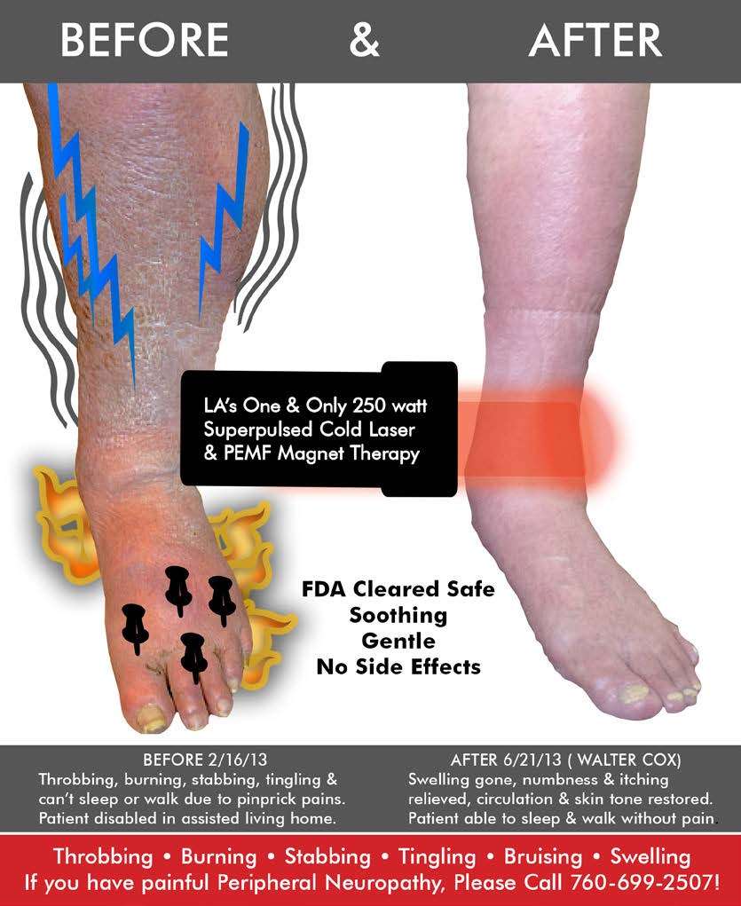 Relieve the Pain &  Numbness in Your Feet, Knees &  Legs  Dr. Phillip Yoo