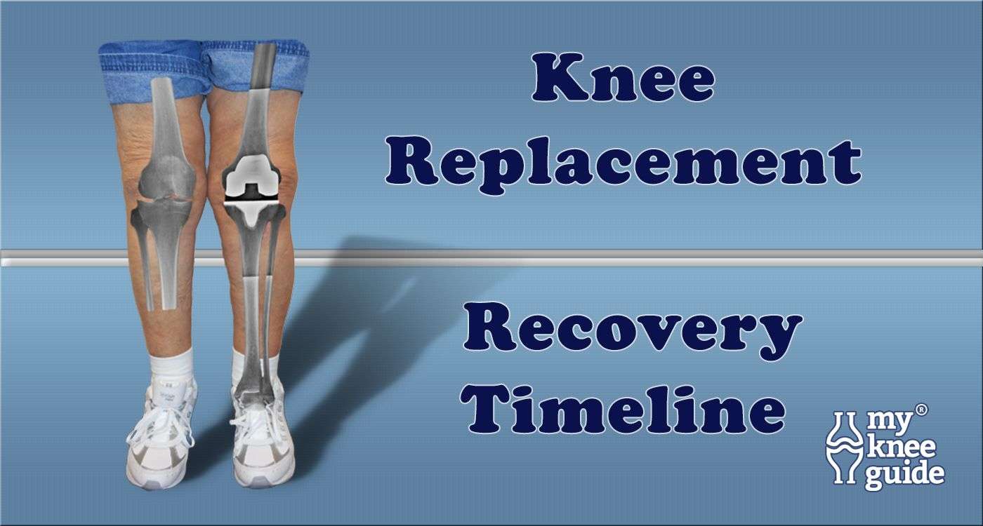Road to Recovery following Knee Replacement