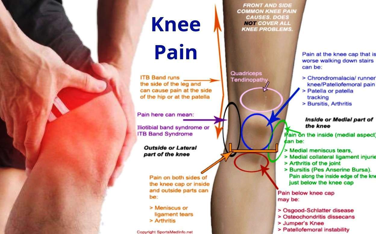severe pain below knee cap ...