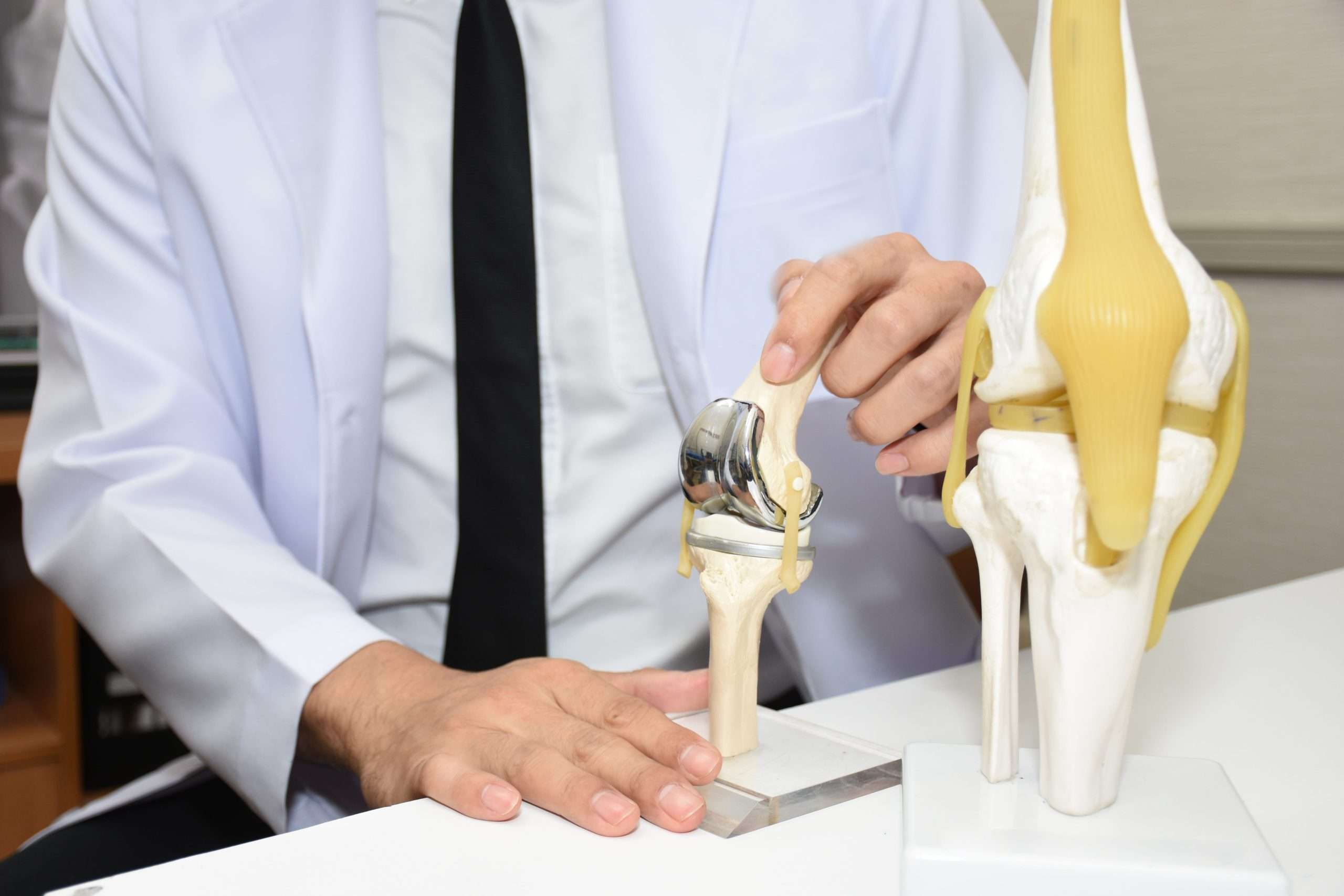 Should I Get a Knee Replacement?