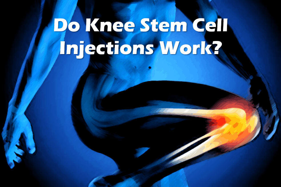 stem cell knee procedures