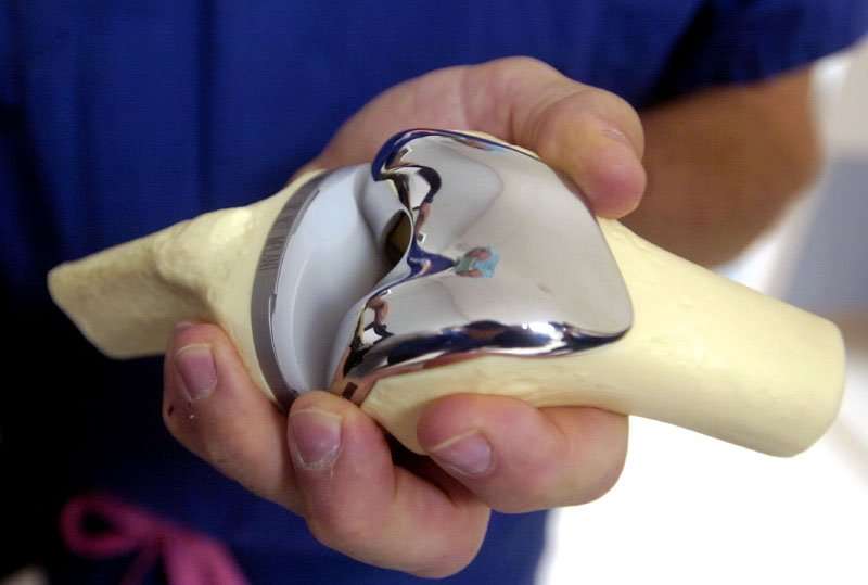 stryker total knee replacement problems