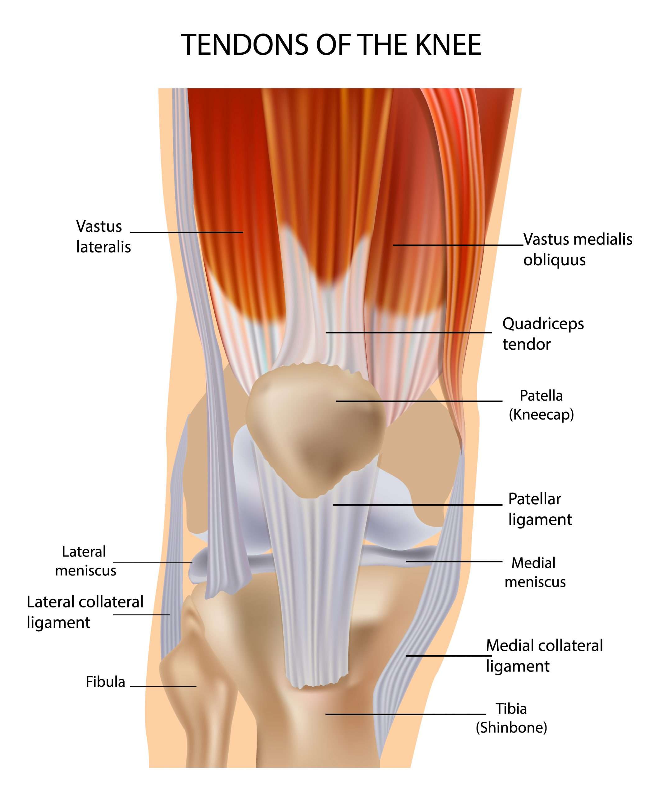 Tendon and Bursitis Problems in the Knee