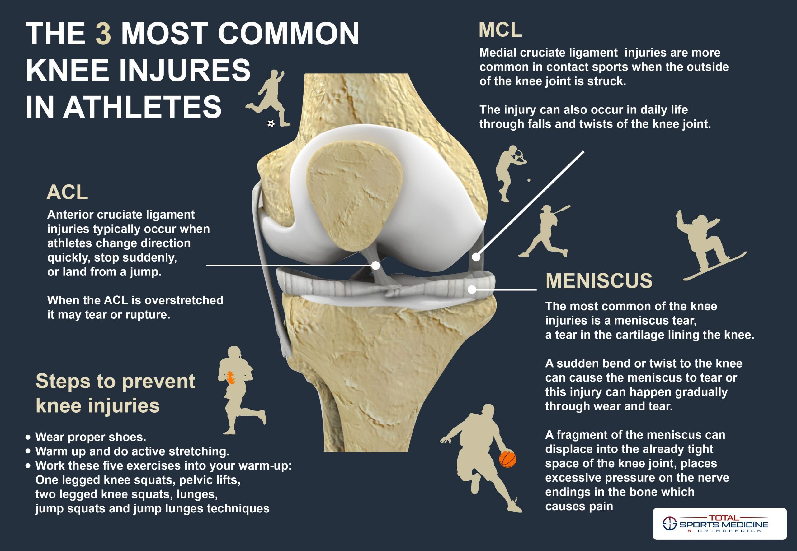The 3 most common knee injuries in athletes