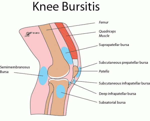 The most common knee injuries and disorders  Orthomen