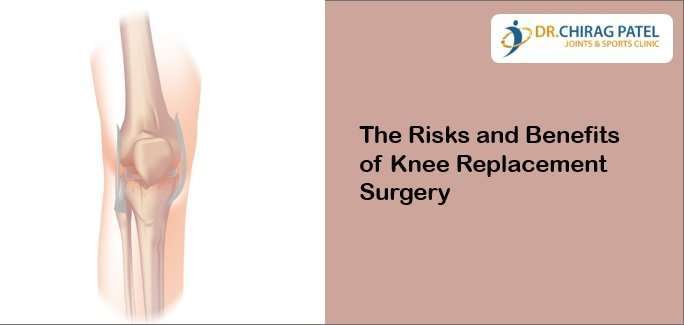 The Risks and Benefits of Knee Replacement Surgery
