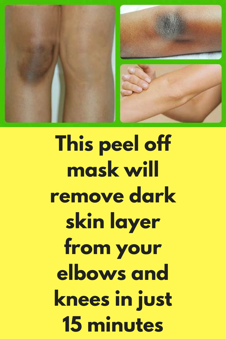 This peel off mask will remove dark skin layer from your elbows and ...