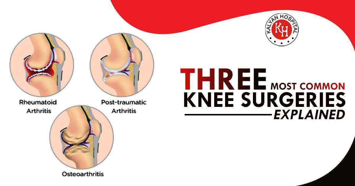 Three Most Common knee Surgeries  Explained # ...