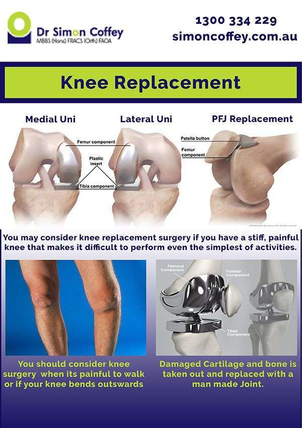 Three Types Of Knee Replacement