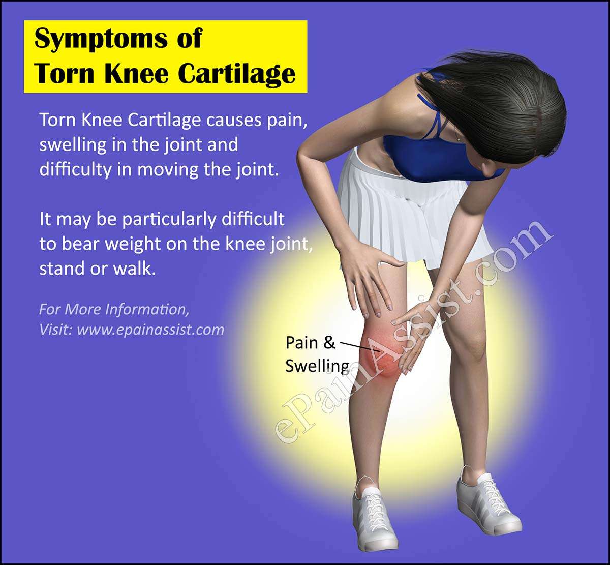 Torn Knee Cartilage