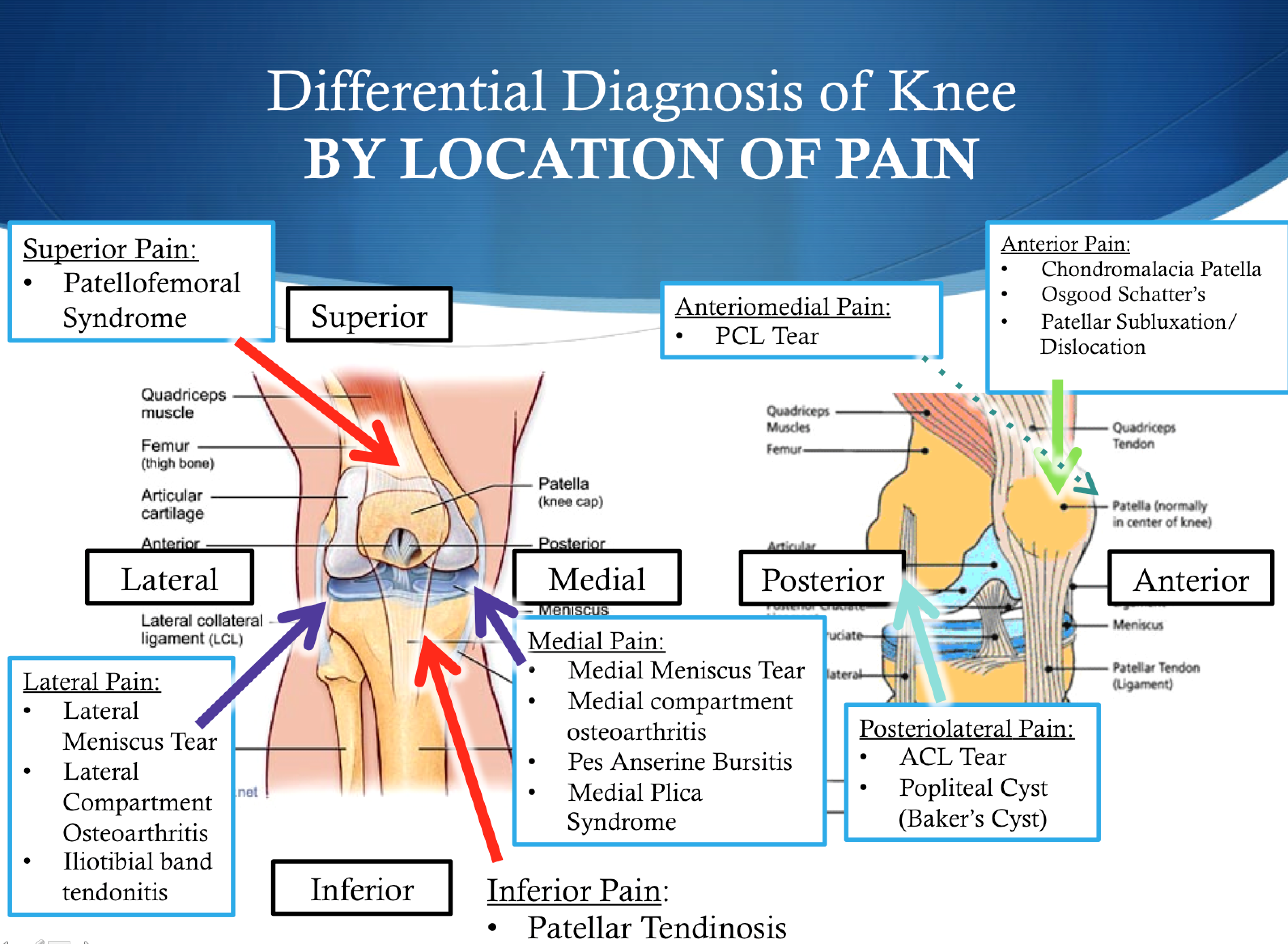 Torn Mcl Knee treatment