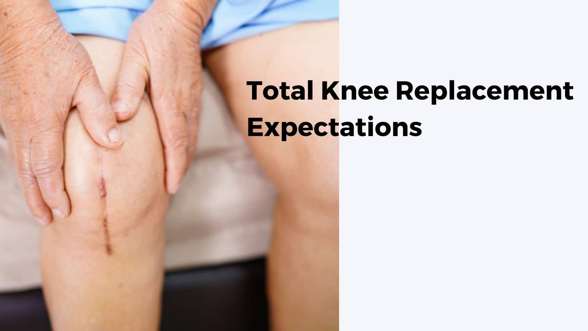 Total Knee Replacement Expectations