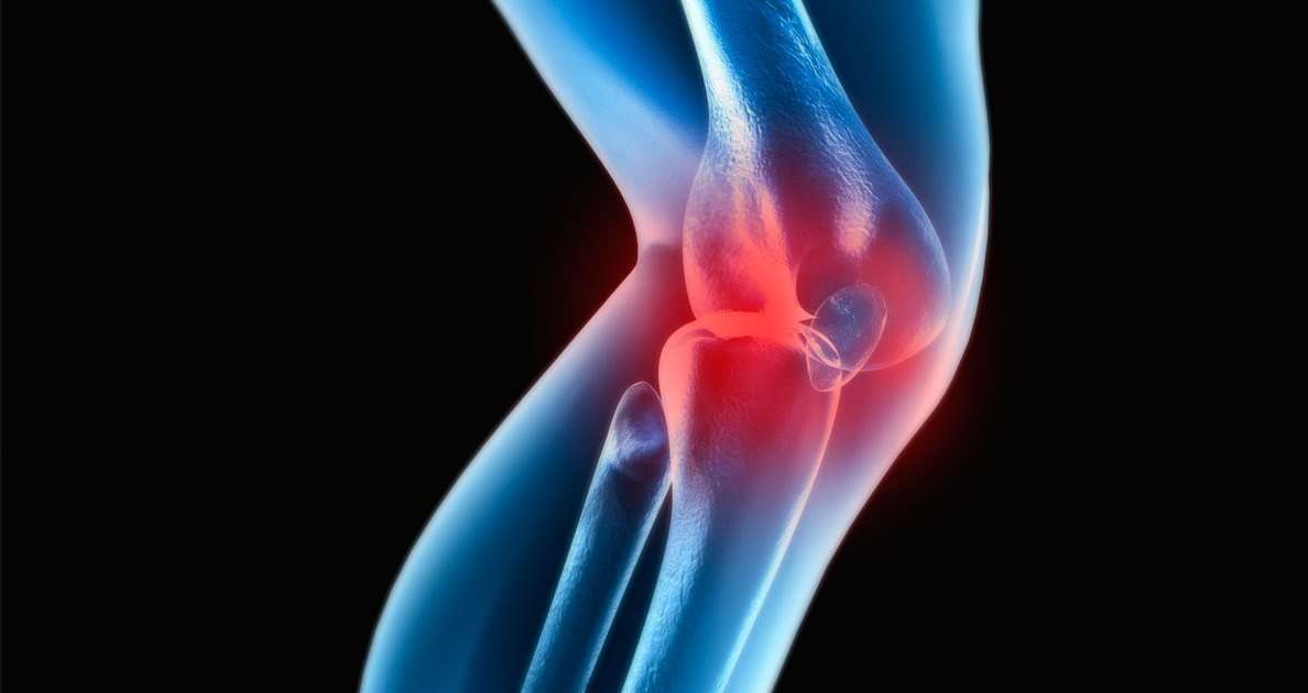 Trainer Q& A: Why Does My Knee Crack and Pop?