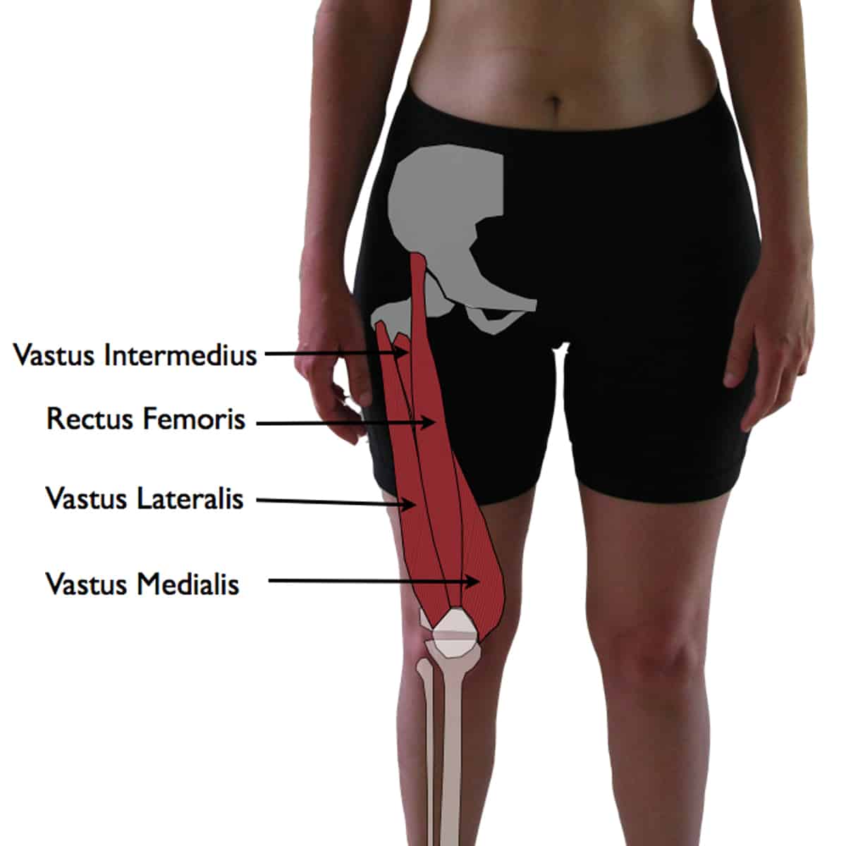 Vastus Lateralis Trigger Points: The Knee Pain Trigger Points