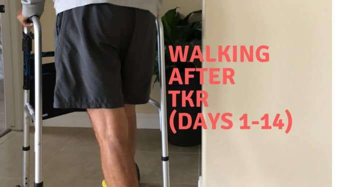 Walking Two Weeks After Knee Replacement (Photos)
