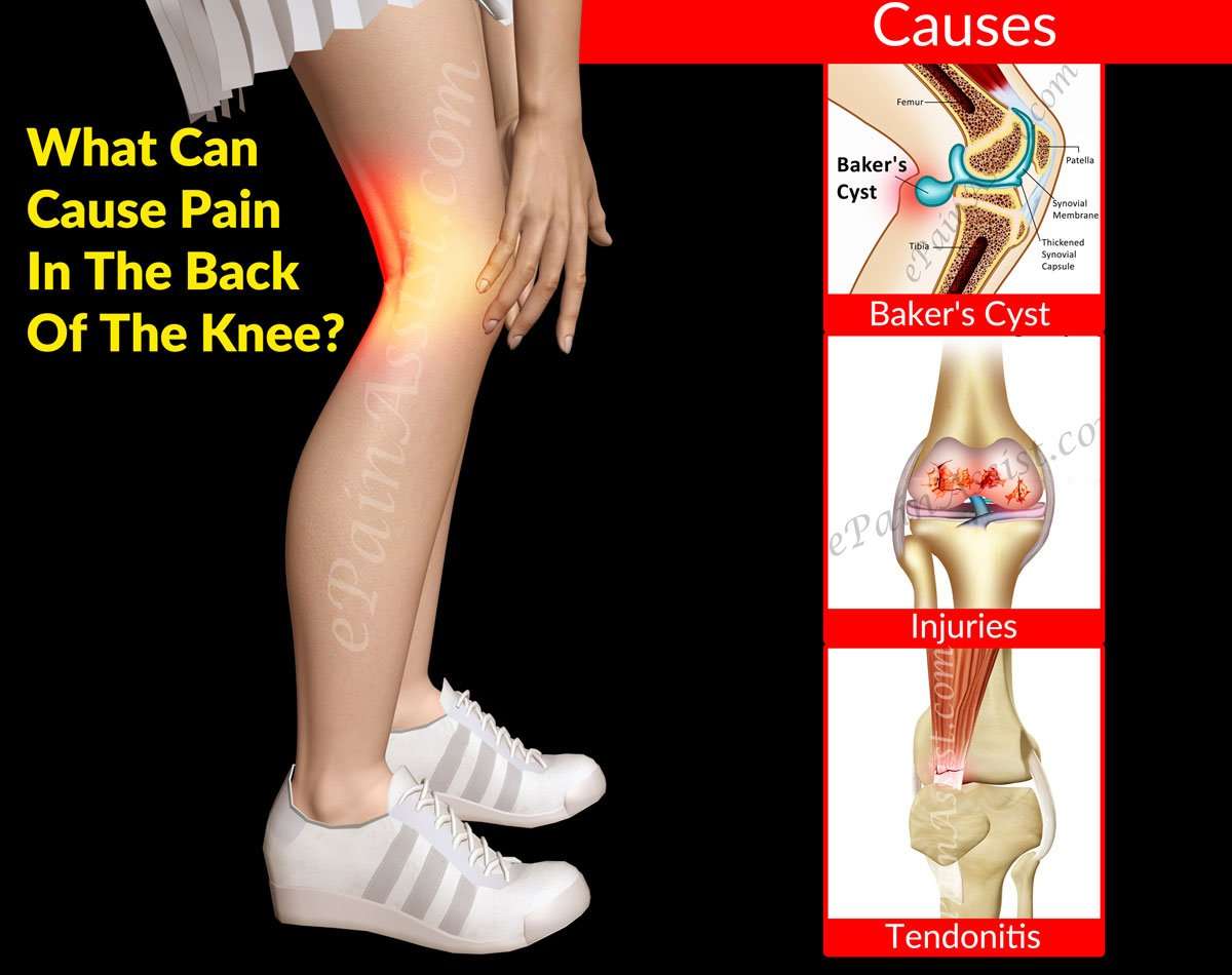 What Can Cause Pain In The Back Of The Knee?