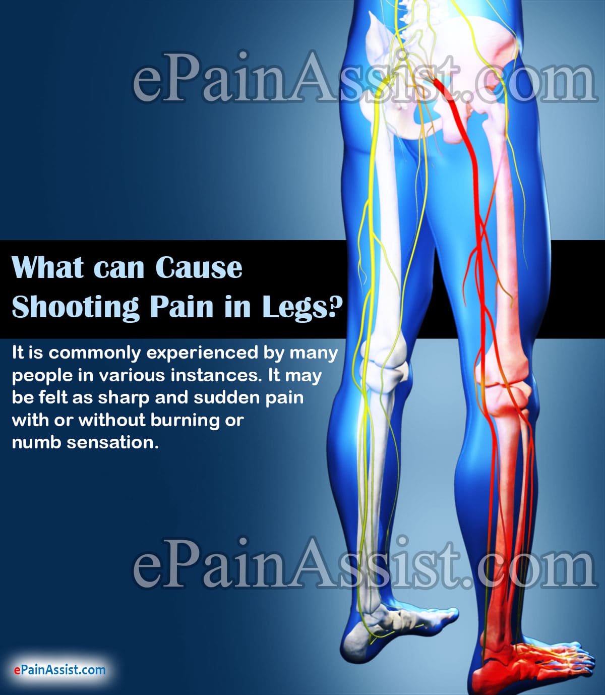 What can Cause Shooting Pain in Legs?