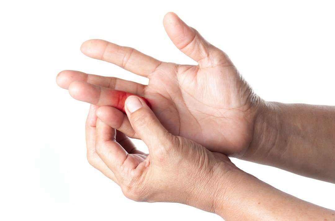 What Can You Take For Arthritis In Your Fingers