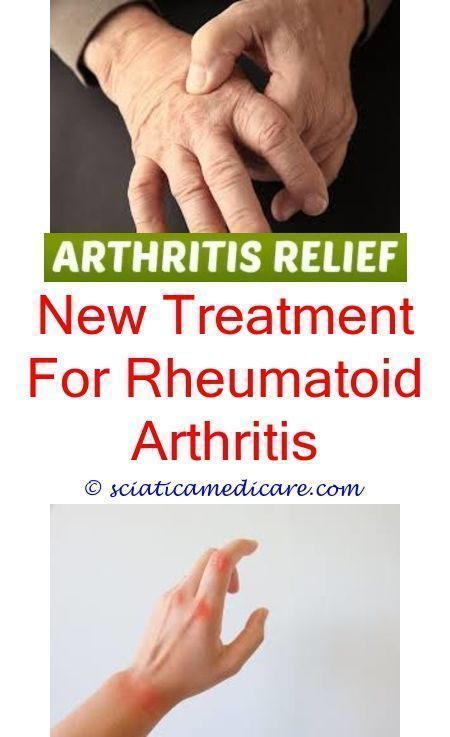 what causes arthritis food for gout arthritis patient ...