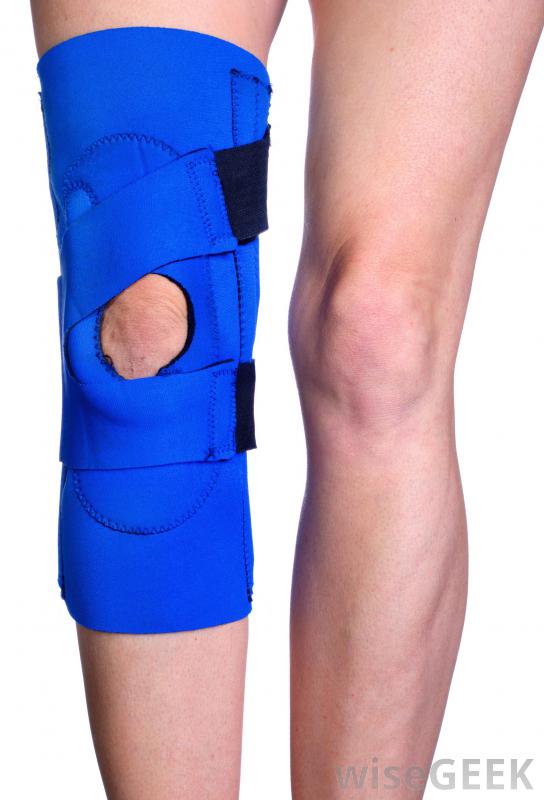 What is a Hinged Knee Brace? (with pictures)