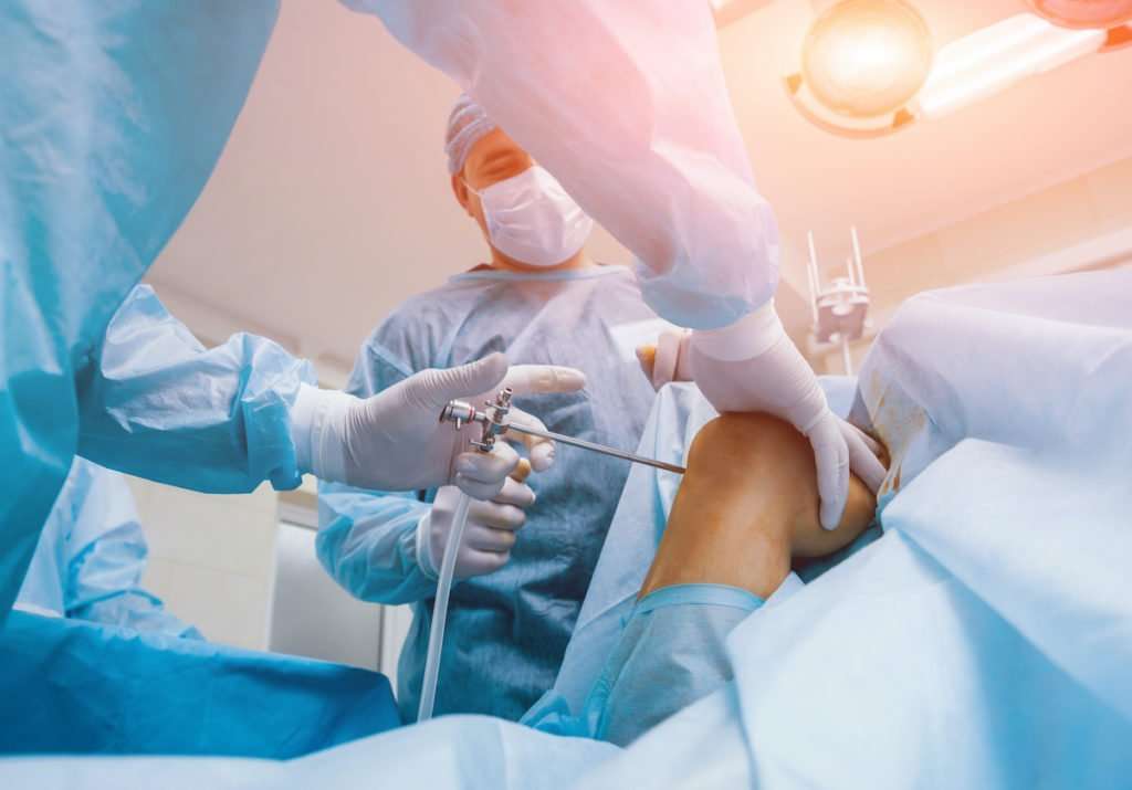 What is Arthroscopic Knee Surgery?