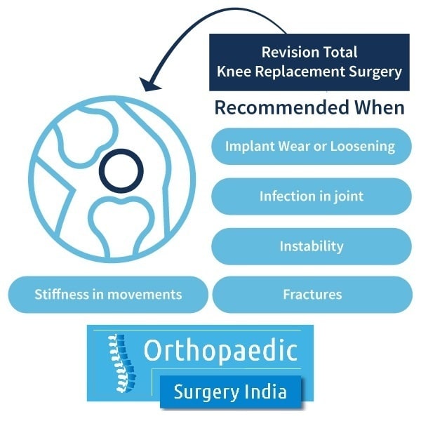 What is minimum cost for Knee replacement surgery in India?