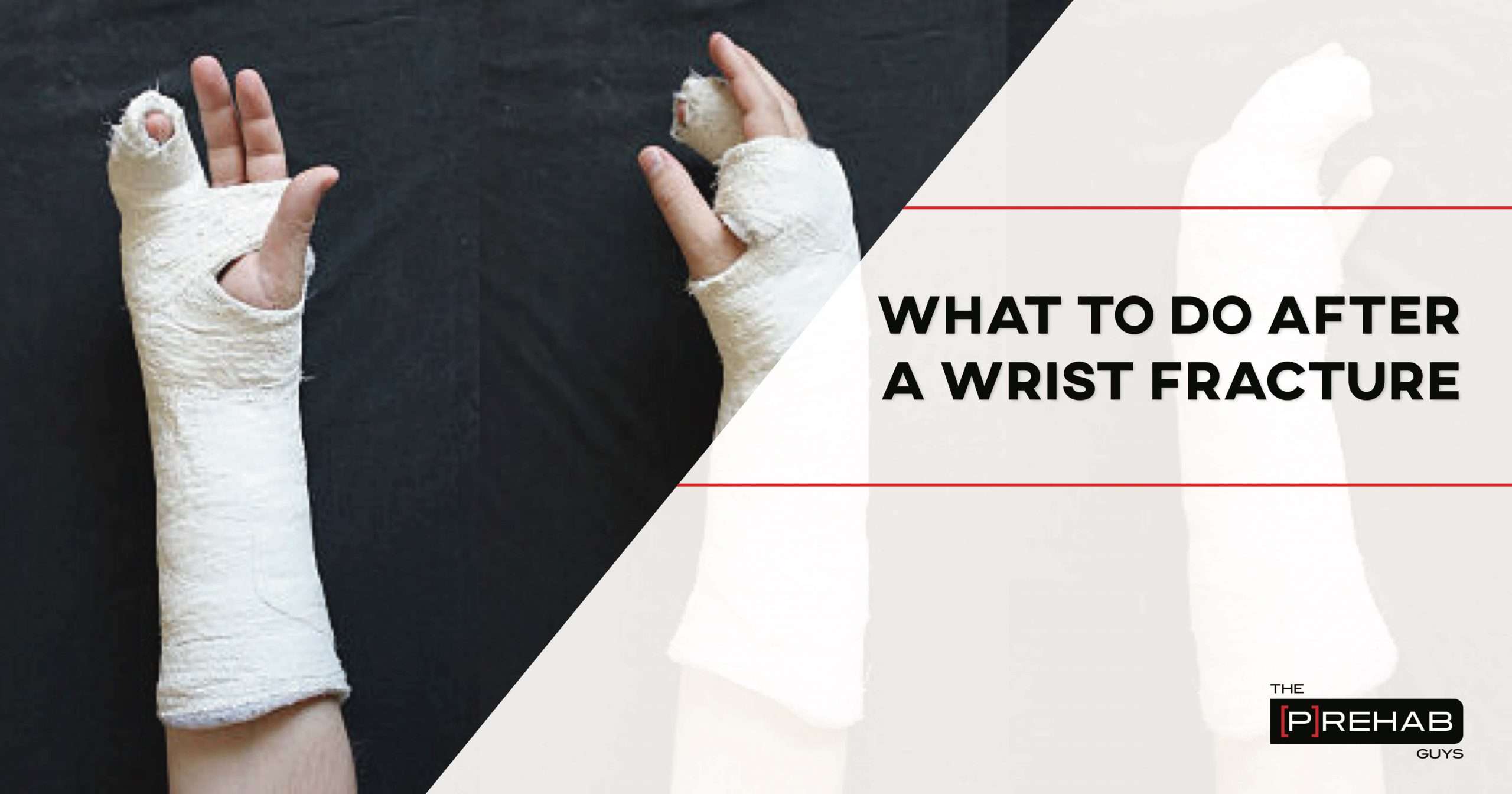 What To Do After A Wrist Fracture With Exercises