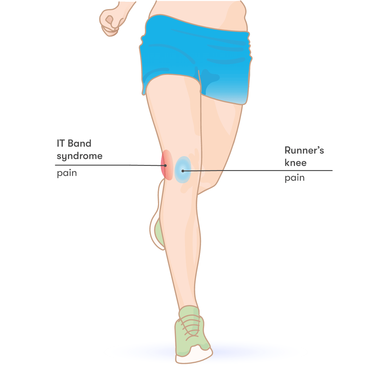 What To Do For It Band Knee Pain