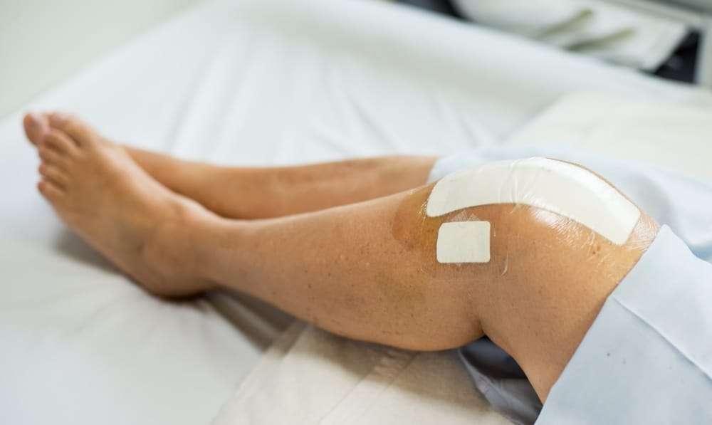 What to Expect from Knee Surgery Recovery