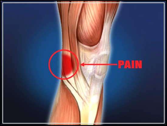Whats Wrong with Pain behind the Knee