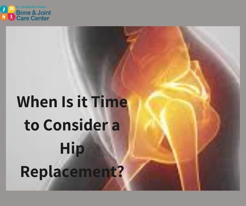 When Is It Time To Consider a Hip Replacement