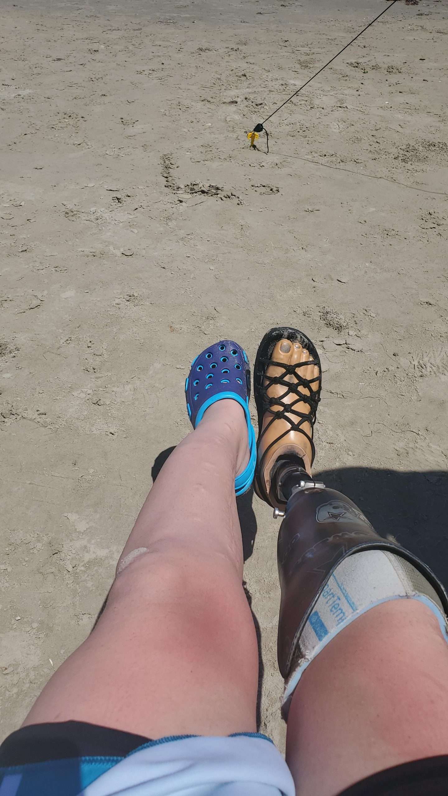 When you get hit by a big wave and your water prosthesic and water shoe ...
