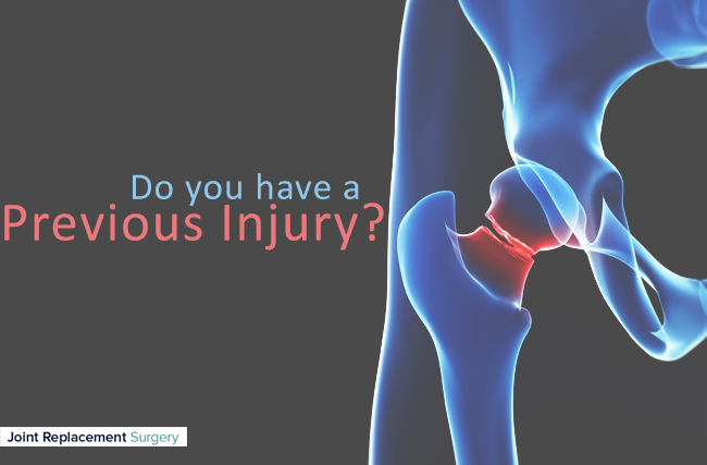 Why You May Need Hip or Knee Replacement Surgery