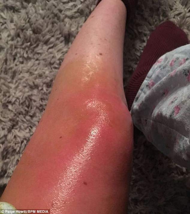 Woman, 24, who suffers constant pain is considering paying Â£9,000 to ...